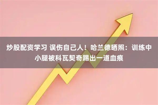 炒股配资学习 误伤自己人！哈兰德晒照：训练中小腿被科瓦契奇踢出一道血痕